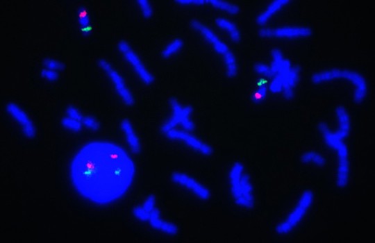 New to FISH? Learn about common FISH signal patterns Image
