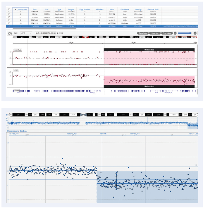 A 7.3MB deletion on chromosome 11 with a stretch of LOH