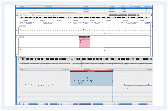 Figure 3: A 65.8Kb duplication on chromosome 2.