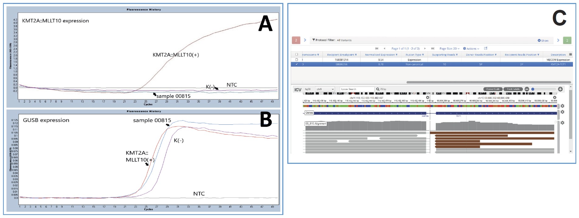 <b>Figure 1:</b> <i>KMT2A::MLLT10</i> rearrangement excluded by qPCR <b>(A and B)</b>, detected by OGT SureSeq™ Myeloid Fusion panel <b>(C)</b>.