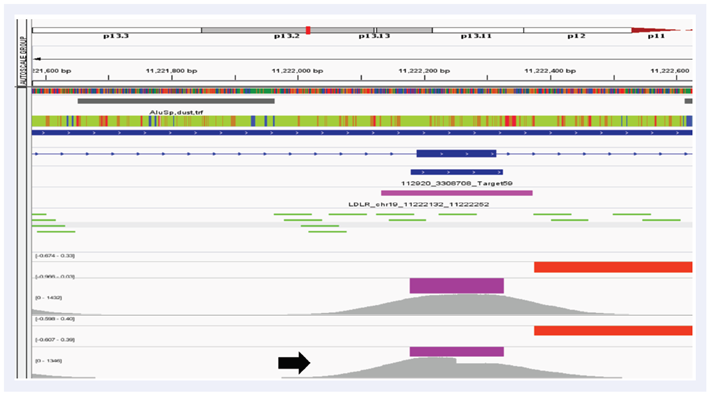 Figure 4: Example of a lower confidence call on LDLR due to a mid-exon breakpoint.