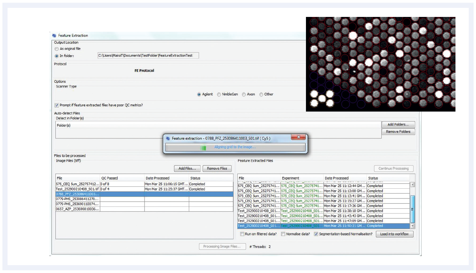 Figure 4: Automated array image analysis with CytoSure Interpret Feature Extraction Module.