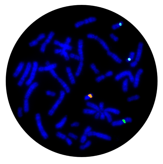 Fluorescence in situ hybridisation (FISH) metaphase result for the X, Y and 18 centromere prenatal FISH probe.