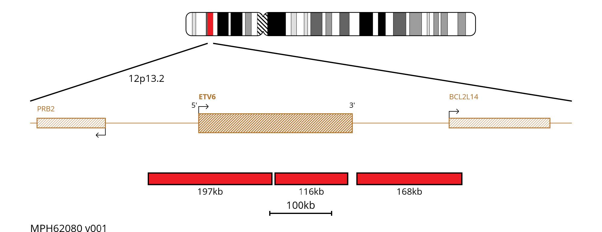 Fluorescence in situ hybridisation (FISH) chromosome map showing red probes targeting the region 12p13.2.