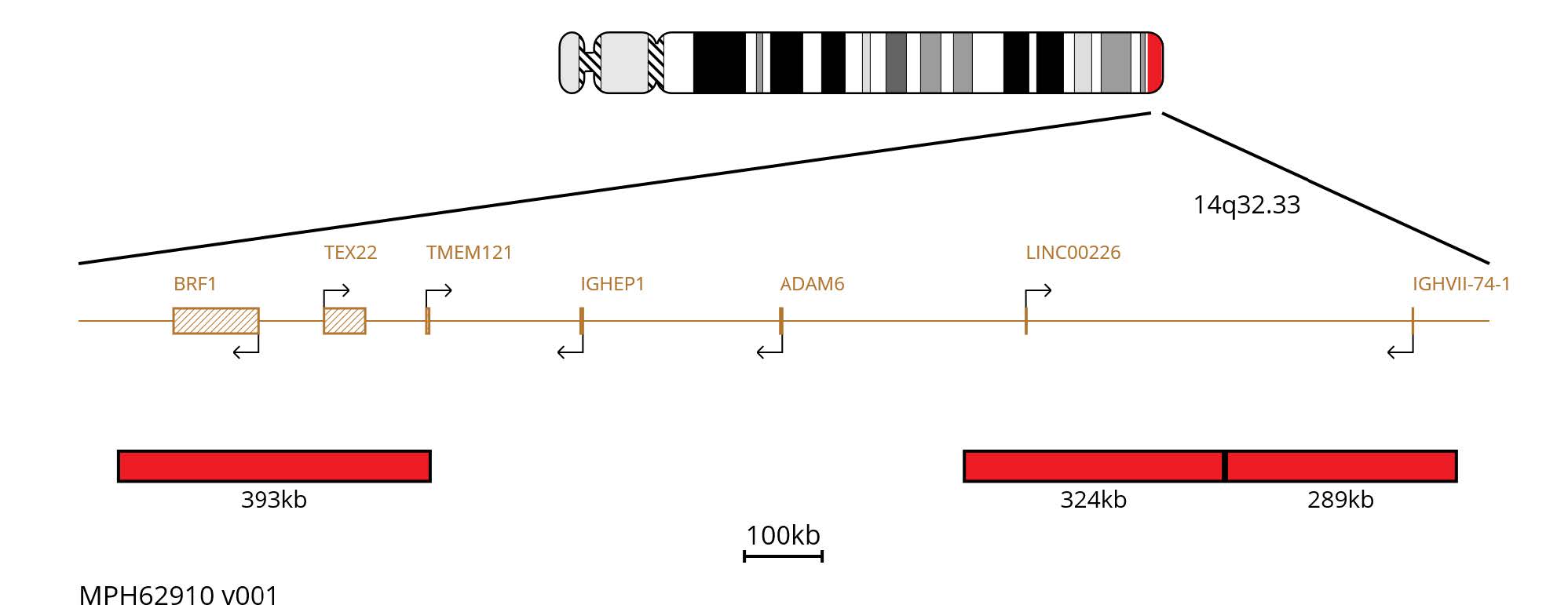 Fluorescence in situ hybridisation (FISH) chromosome map showing red probes targeting the IGH region on chromosome 14.