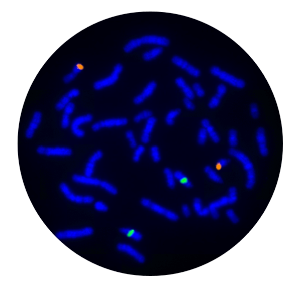 Fluorescence in situ hybridisation (FISH) metaphase result for the 13q14.2 and 21q22.13 prenatal FISH probe.