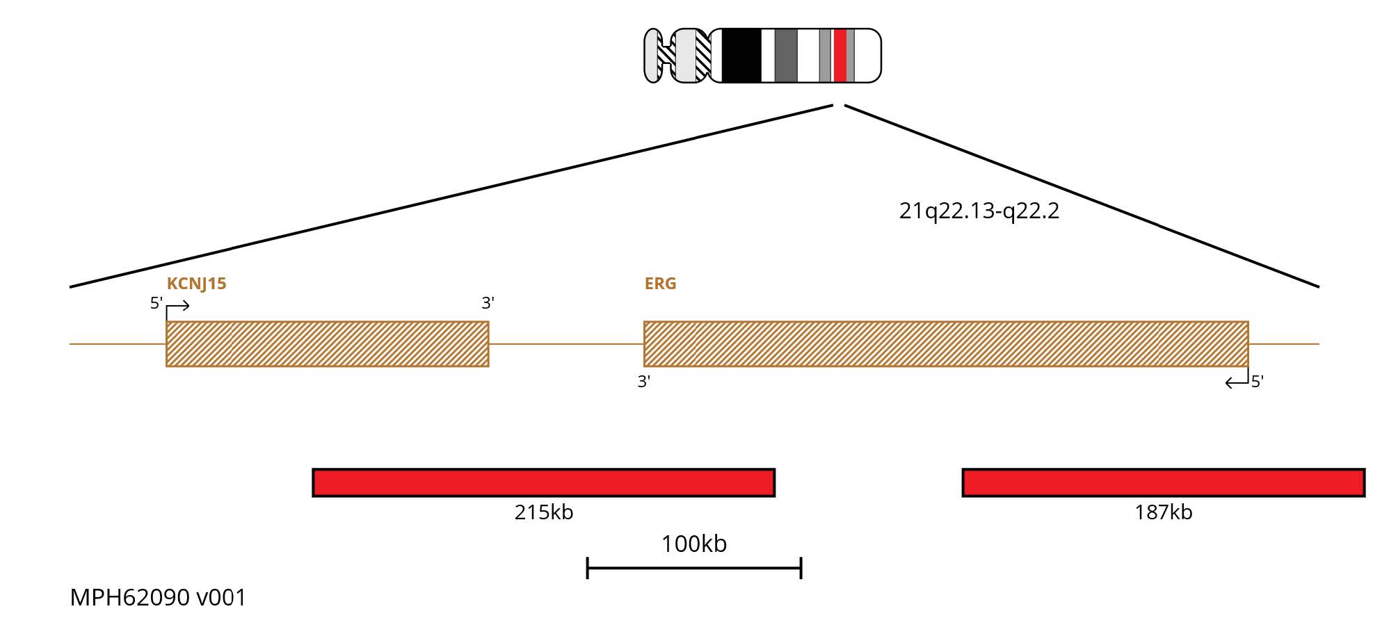 Fluorescence in situ hybridisation (FISH) chromosome map showing two red probes targeting the ERG gene.