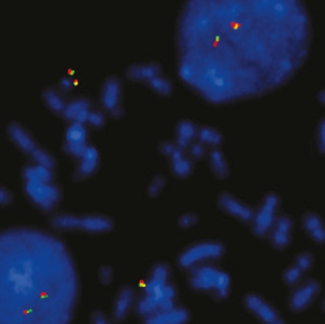 3 reasons to switch to IVDR CytoCell FISH probes Image