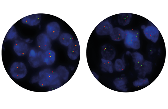 Try our frequently-ordered CytoCell pathology probes Image