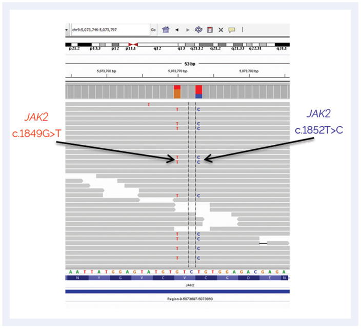 Figure 1: IGV genome viewer showing the analysis of the NGS data with arrows showing the newly identified mutations not detected by ddPCR
