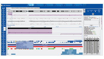 Array Cytosure Interpret Data
