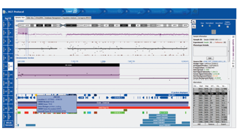 Array Cytosure Interpret Data