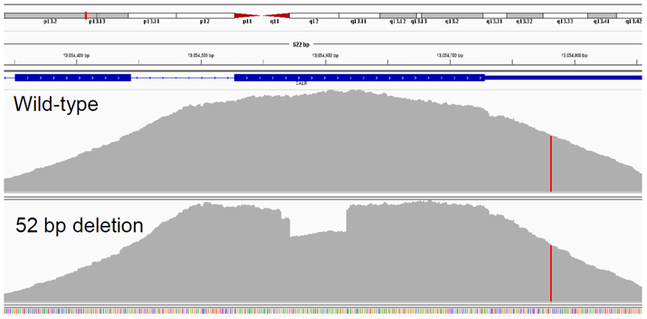 Figure 2: Detection of a 52 bp deletion (exon 9 CALR).