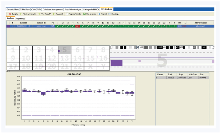 Figure 3: Detection of a 15Mb deletion on chromosome 5 in sample NA14117, using a CytoSure Embryo Screen Array.