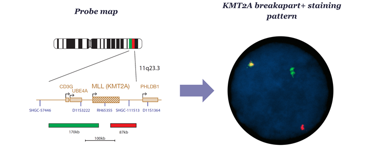 OGT's IVDR-approved CytoCell MLL (KMT2A) Breakapart FISH Probe