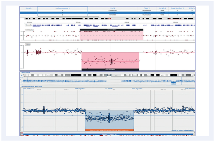 Figure 5: A 5.91MB deletion on chromosome 1.