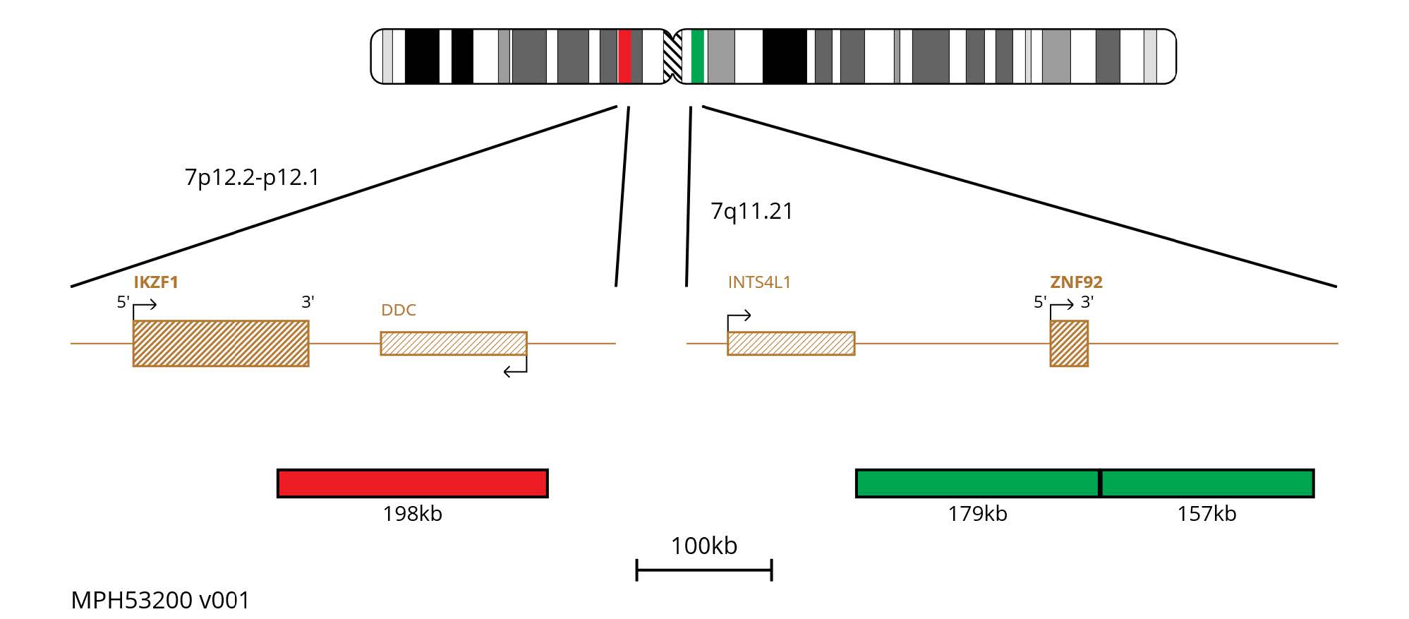 Fluorescence in situ hybridisation (FISH) chromosome map showing probes targeting the IKZF1 gene and 7q11.21 region.