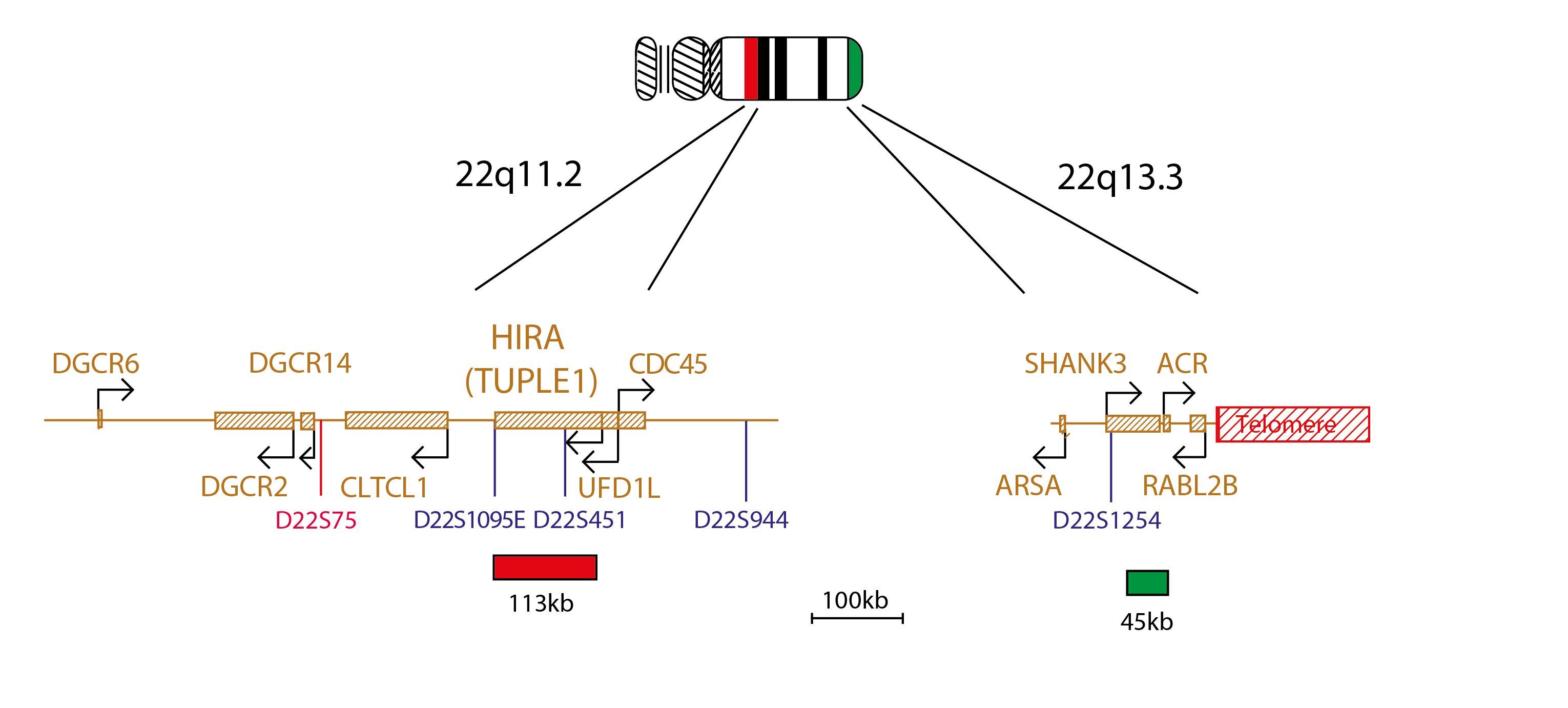 Fluorescence in situ hybridization (FISH) chromosome map showing probes targeting regions 22q11.2 (TUPLE) and 22q13.3.
