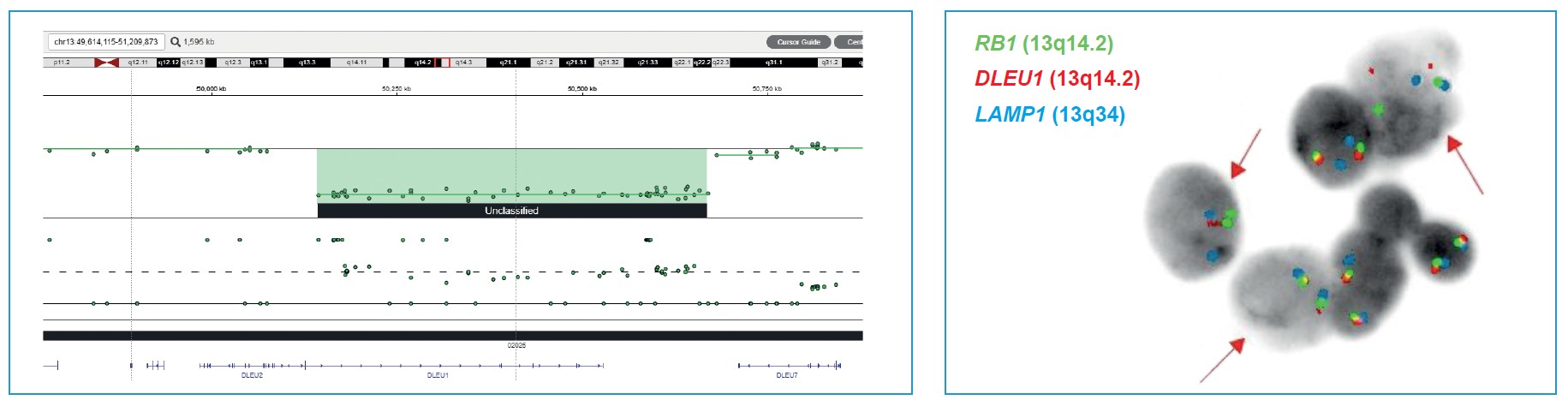 <b>Figure 1a:</b> OGT’s Interpret NGS Analysis Software visualisation and FISH result of a small (450kbp) deletion in 13q (sampleCG136), resulting in a partial deletion of <i>DLEU1</i> locus.