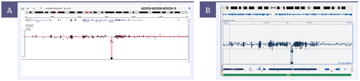 Figure 2: Single exon deletion in a female DMD sample