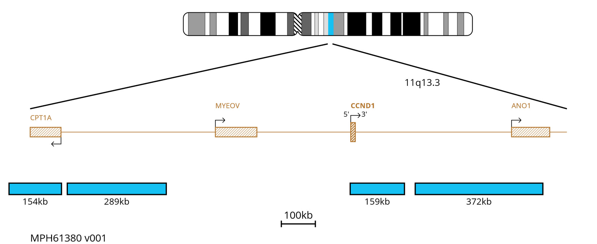 Fluorescence in situ hybridisation (FISH) chromosome map showing aqua probes targeting the CCND1 gene.