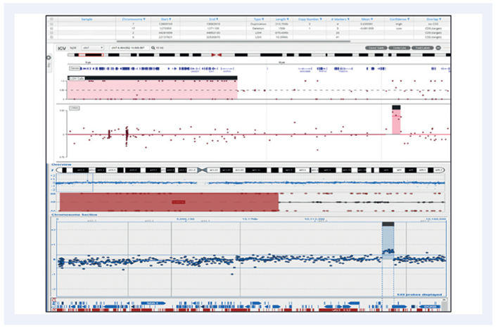 Figure 4: 10.39Mb LOH and a 213.75Kb duplication on chromosome 7
