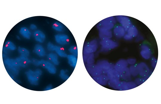 Try our frequently-ordered CytoCell pathology probes Image