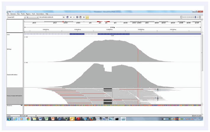 Figure 11. Superior uniformity of coverage allows reliable detection of indels even as big as 1/3 of a read length.