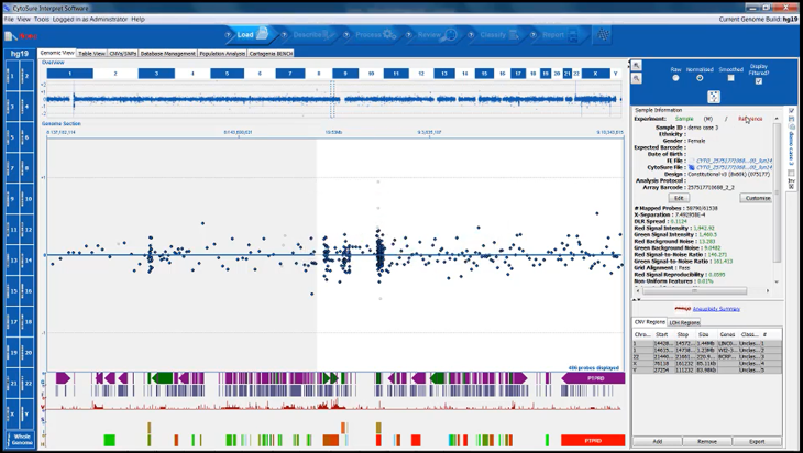 CytoSure Interpret aCGH software - Probe filtering (5 minutes) Image