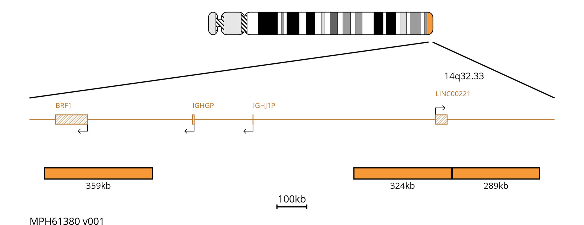 Fluorescence in situ hybridisation (FISH) chromosome map showing orange probes targeting the IGH region.