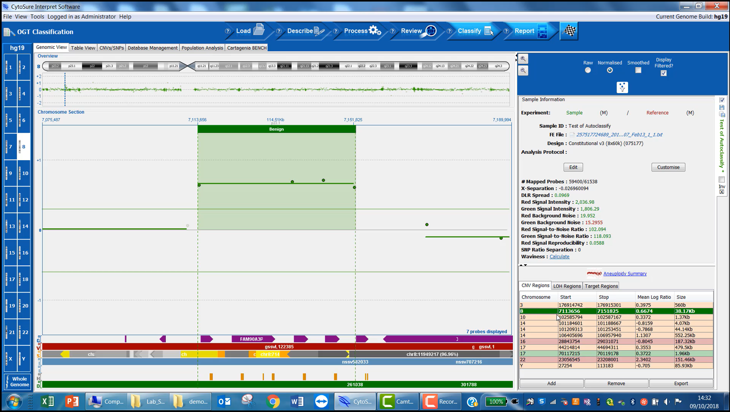 CytoSure Interpret aCGH software - Automatic classification of aberrations (7 minutes) Image