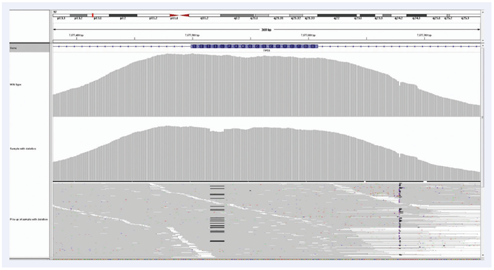 Figure 9. High uniformity of coverage allows the reliable detection of lowfrequency somatic indels even in FFPE derived DNA.