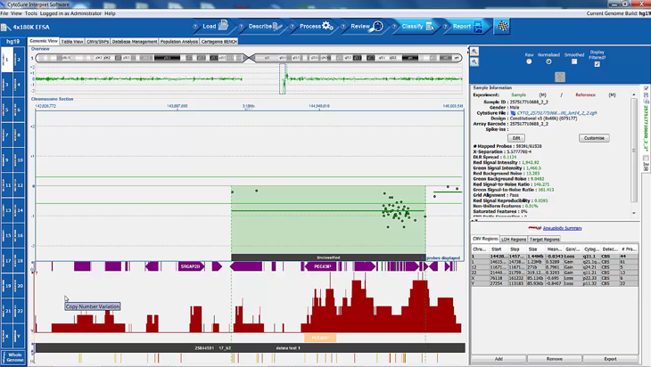 CytoSure Interpret aCGH software - Loading, reviewing and reporting the analysis of aCGH data (11 minutes) Image