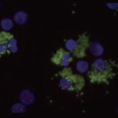 Inadequate signals with CD138+ cells Image