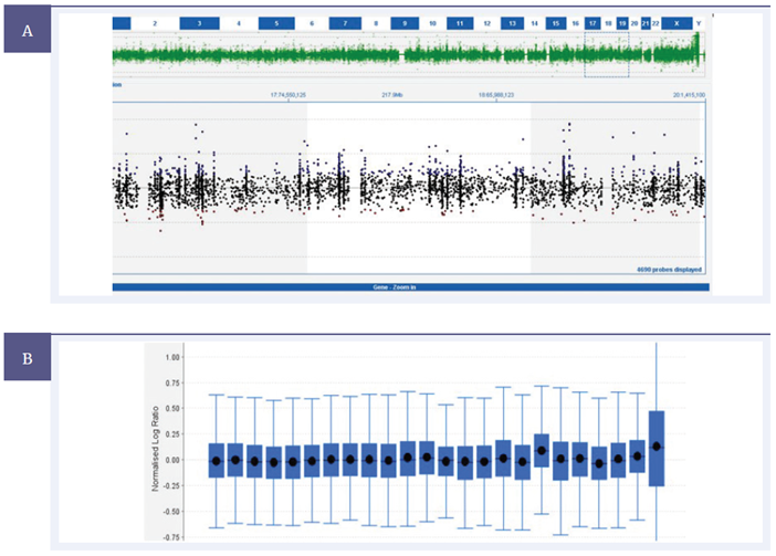 opy number trace of CytoSure Constitutional v3 probes across Chromosome 18 from a mosaic trisomy 18 sample using the CytoSure Interpret Software