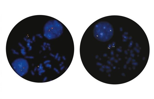 Hematology FISH Probes Offer Canada