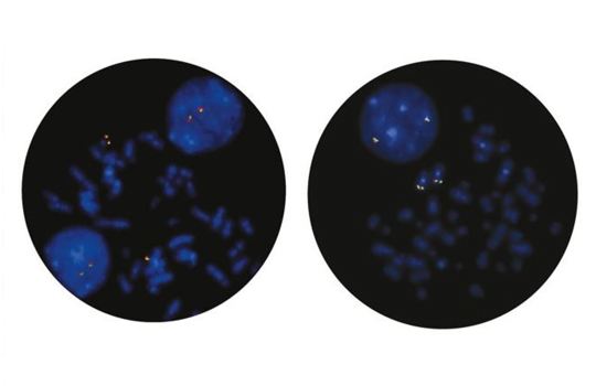 Hematology FISH Probes Offer Canada