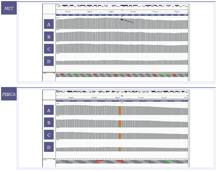 Figure 7: IGV plots of regions of the MET and PI3KCA genes of the sample with severe damage