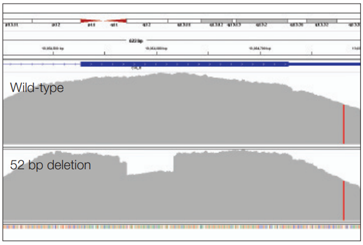 Figure 2: Detection of a 52 bp deletion (exon 9 CALR).