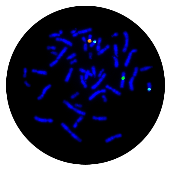 Fluorescence in situ hybridisation (FISH) metaphase result for the X, Y and 18 centromere prenatal FISH probe.