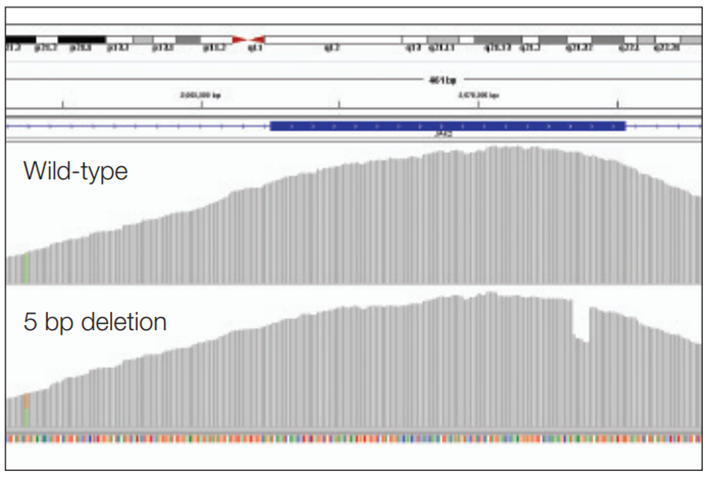 Figure 3: Detection of a 5 bp deletion (exon 12 JAK2 ).