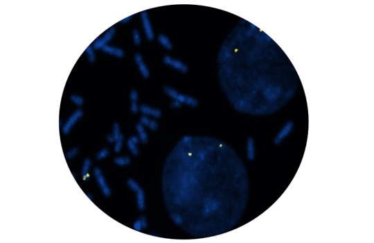 Featured Pathology FISH Probes Image