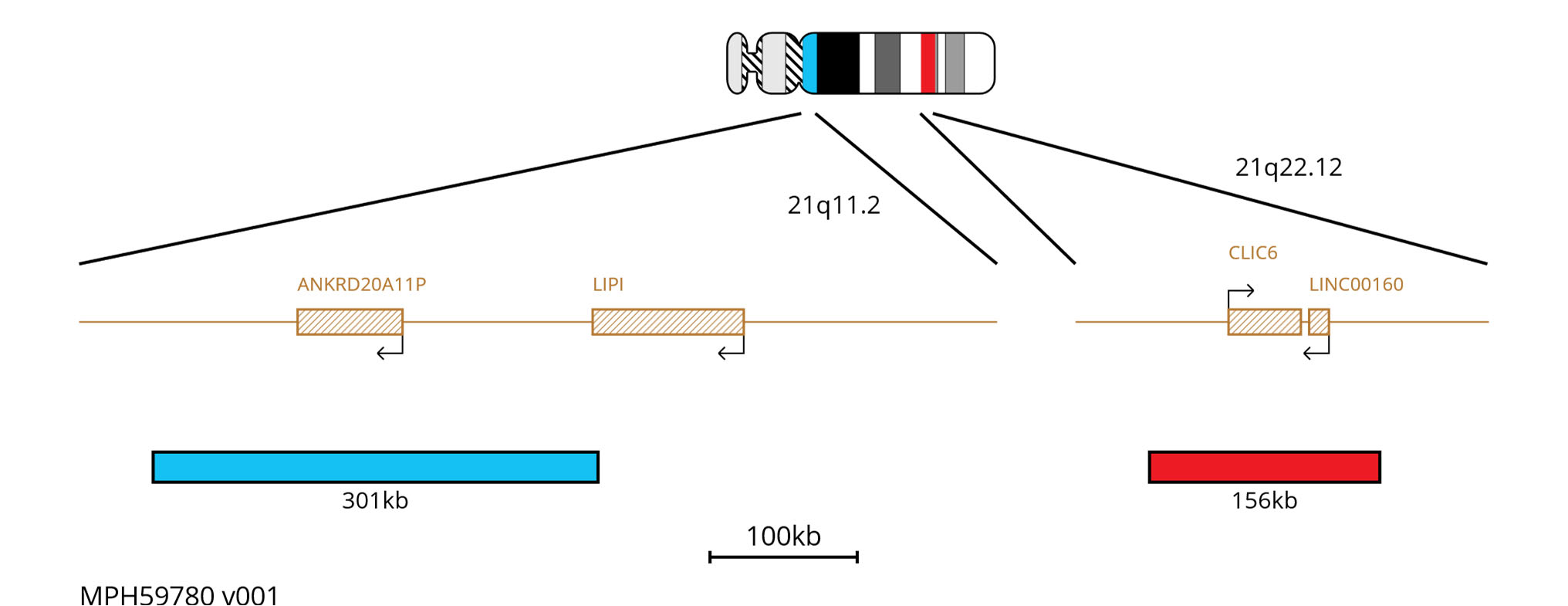 Fluorescence in situ hybridisation (FISH) chromosome map showing probes targeting the RUNX1 gene and 21q11.2 region.