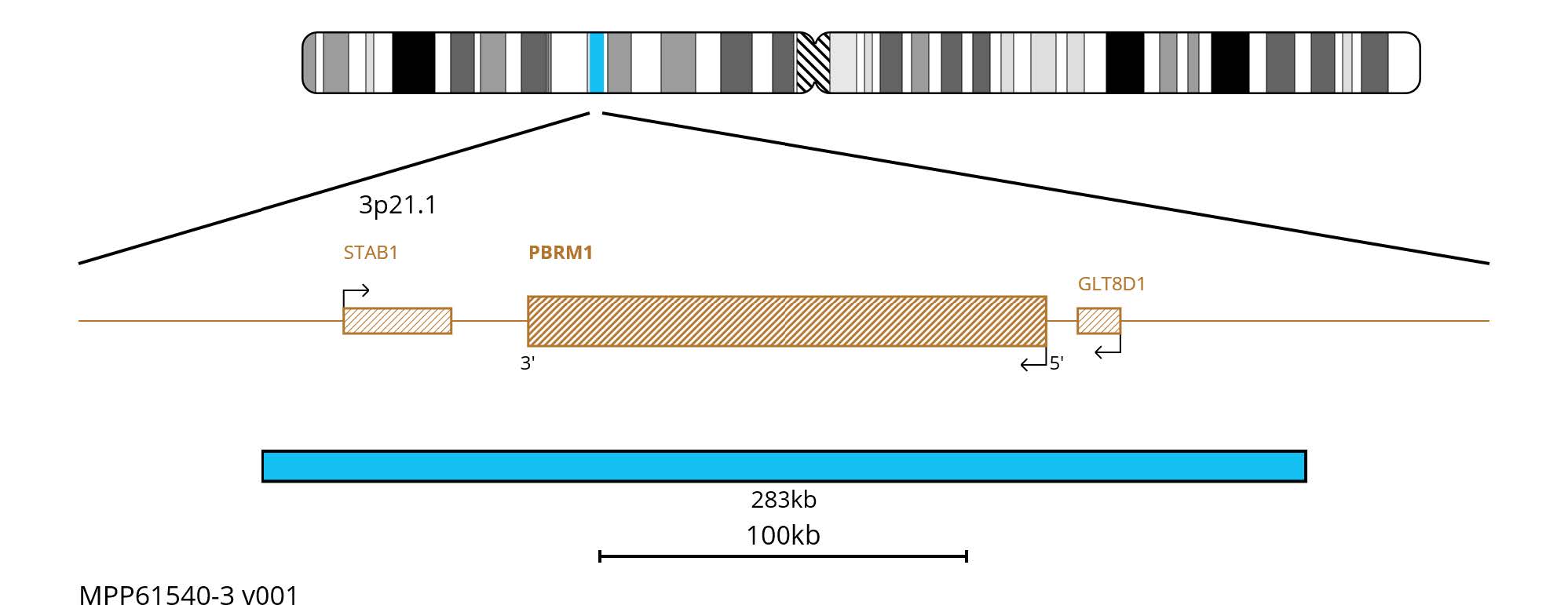Fluorescence in situ hybridisation (FISH) chromosome map showing an aqua 283kb probe targeting the PBRM1 gene.