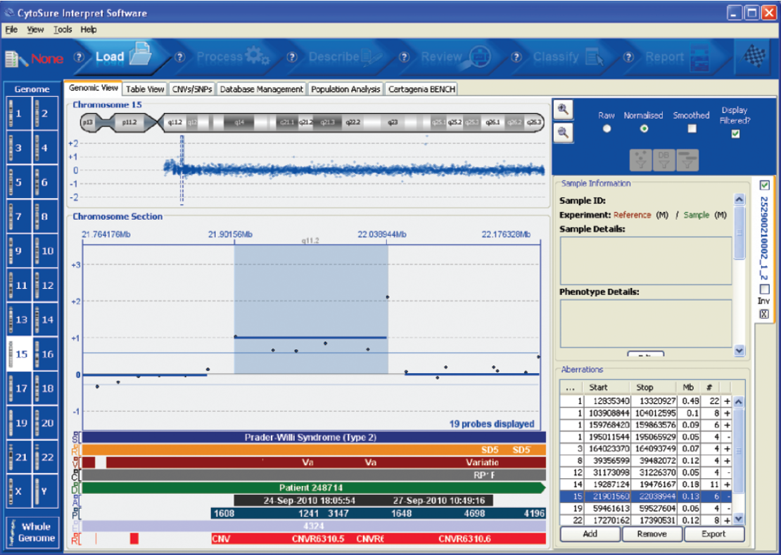 Figure 2: Reliable detection of small aberrations. DNA labelled using the CytoSure Genomic DNA Labelling Kit was run on a CytoSure ISCA 8 x 60k array. CytoSure Interpret Software combined with high DNA signal intensity allowed detection of a small (130kb) DNA amplification.