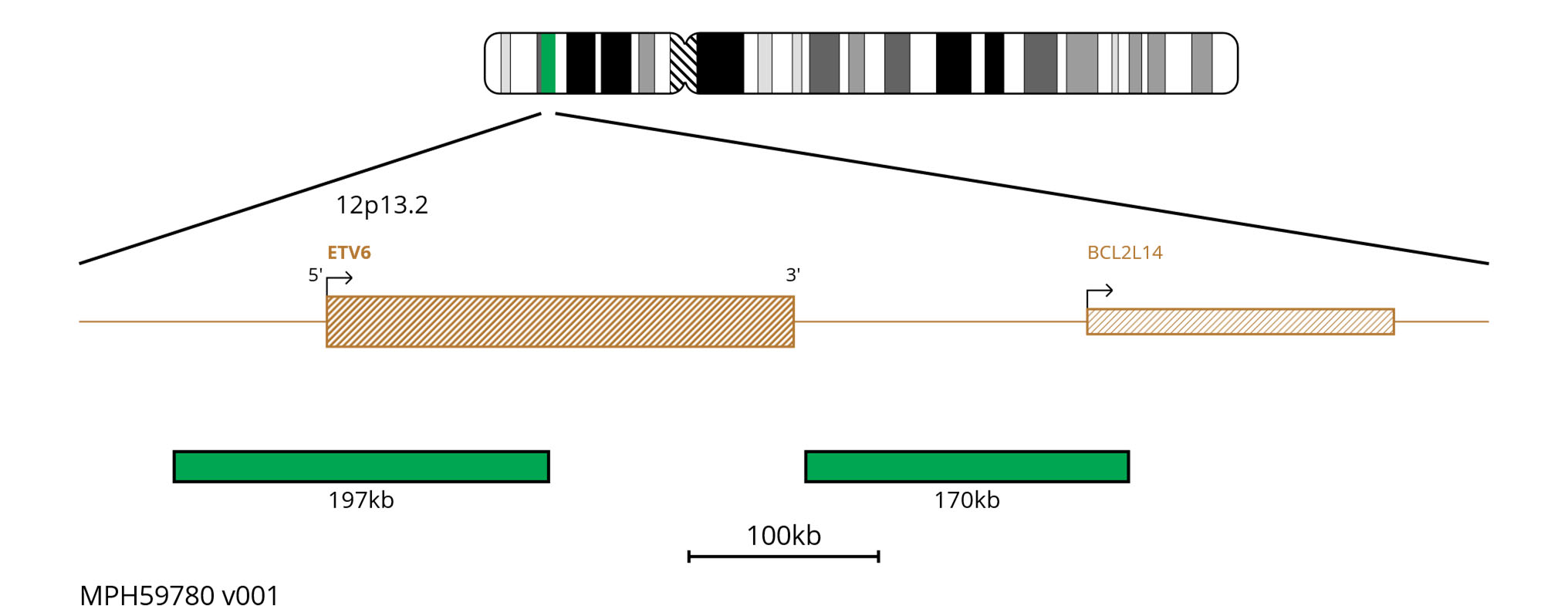Fluorescence in situ hybridisation (FISH) chromosome map showing green probes targeting the ETV6 gene.