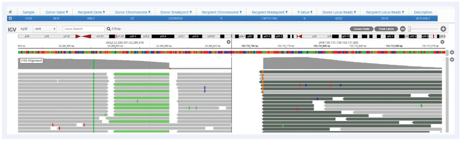 Figure 9: BCR-ABL translocation. Split-reads covering both BCR (left panel) and ABL1 (right panel) are detected, indicative of the BCR-ABL gene fusion. Interpret agnostically detects split-reads across the genome, enabling detection of both known and unknown translocation partners.